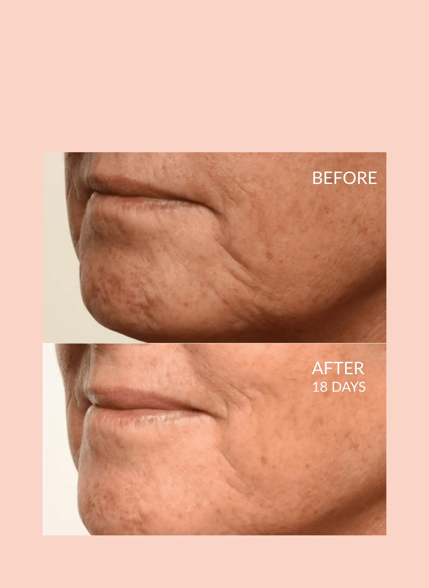 Theorem Serum Boost Caire Beauty